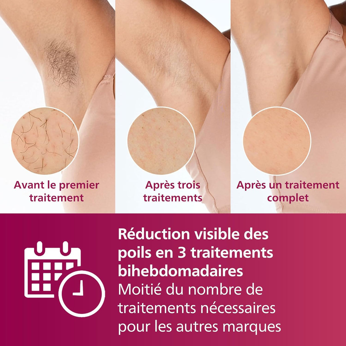 Philips Lumea série 7000, épilateur à lumière pulsée, alternative à l'épilation , avec tondeuse-stylo Satin Compact, 2 embouts pour le corps et le visage, modèle BRI921/00