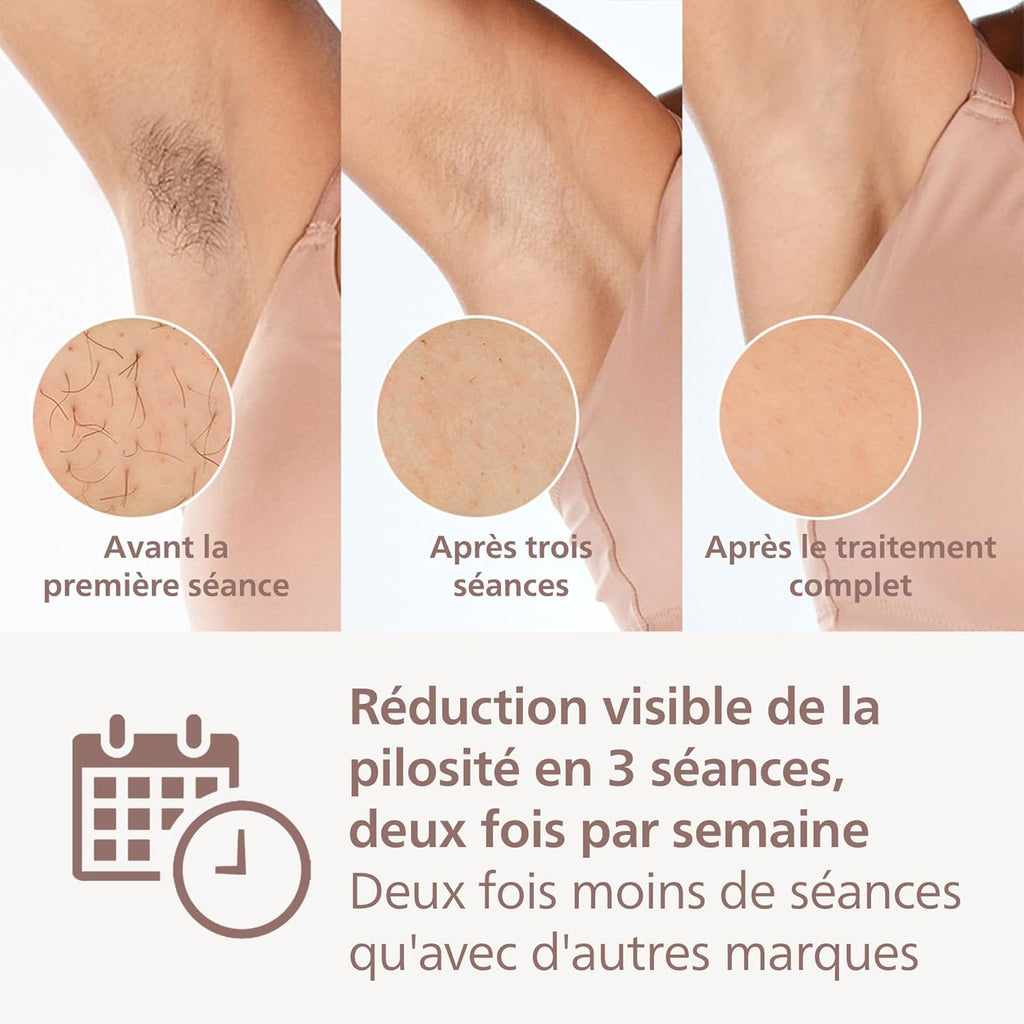 Philips Lumea série 9000, épilateur à lumière pulsée, alternative à l'épilation , technologie SenseIQ, 4 accessoires pour corps, visage, maillot et aisselles, usage avec ou sans fil, BRI957/00
