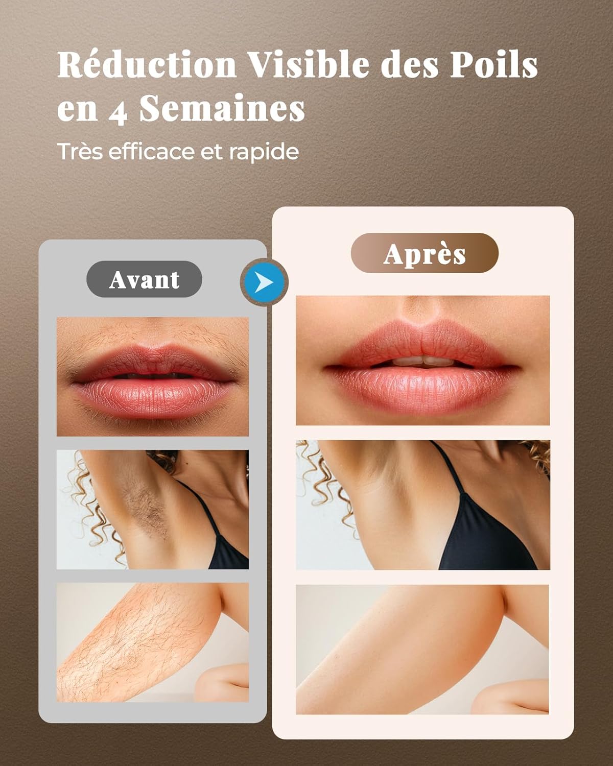 TIIMAGIC épilateur Lumière Pulsée, 9 Niveaux d'énergie IPL épilateur Définitif, 3 en 1 [HR/SC/RA] épilation Hair Removal Indolore pour Visage/Aisselles/Bikini, Femme, Homme - Noir