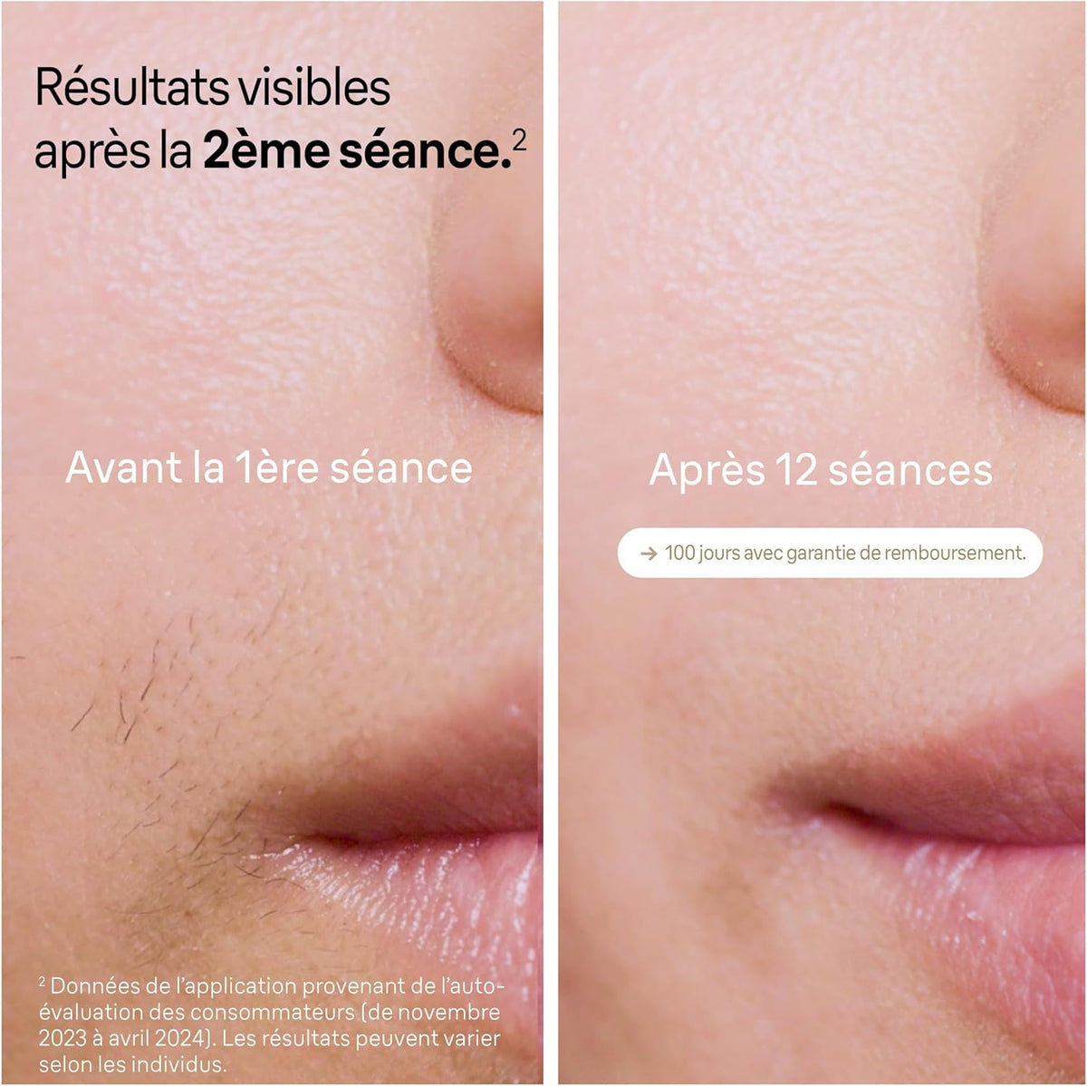 Braun épilateur à Lumière Pulsée Silk·expert Pro 5 PL5342, épilation Semi-Définitive, Alternative Au , Résultats En 2 Séances, Rasoir Venus, 4 Têtes Pour épiler Jambes, Visage, Maillot Et Plus