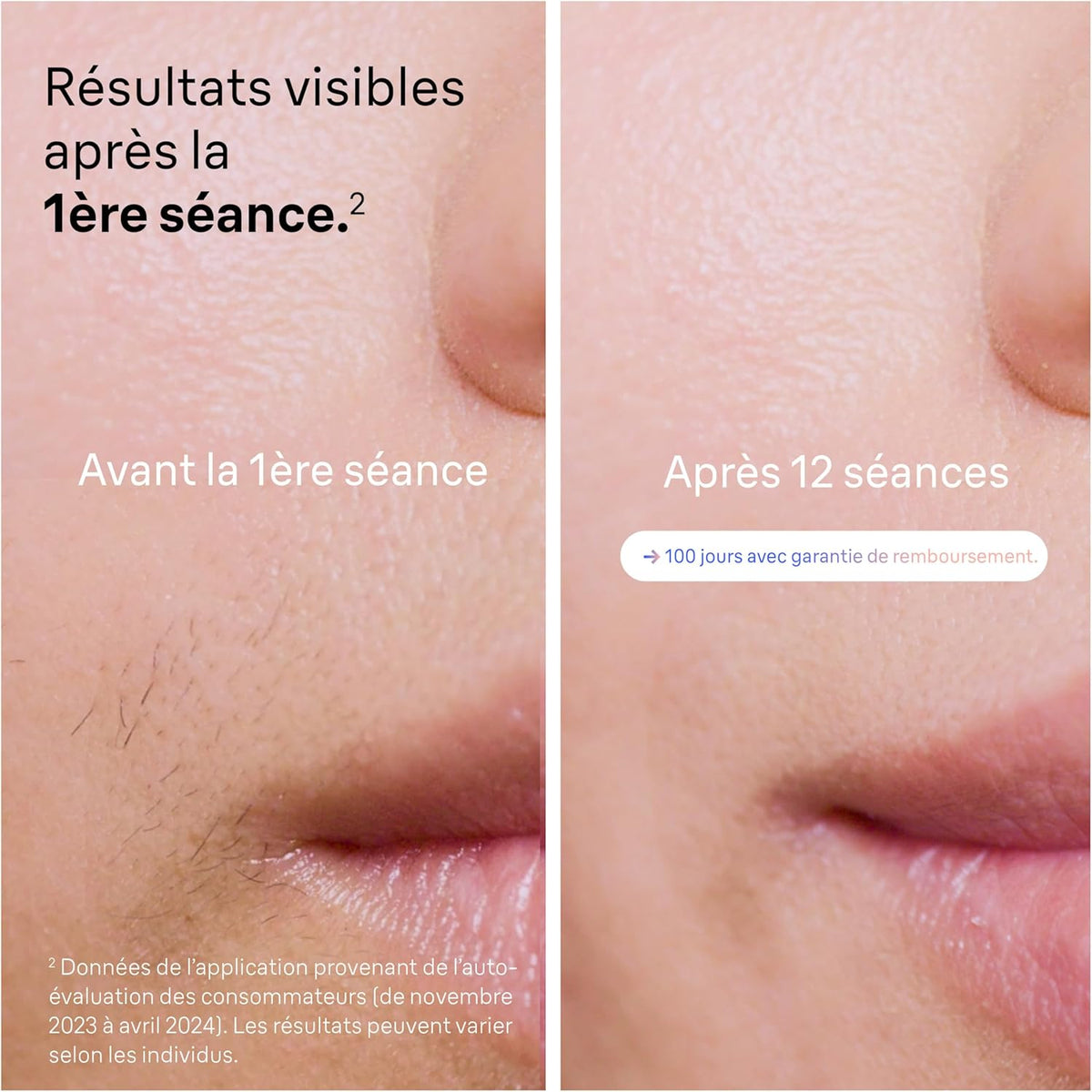 Braun épilateur à Lumière Pulsée Intelligent Skin i·expert PL7387, épilation à Domicile, Alternative Au , Avec Appli, Rasoir Venus, 4 Têtes Intelligentes Pour épiler Jambes, Visage et Plus